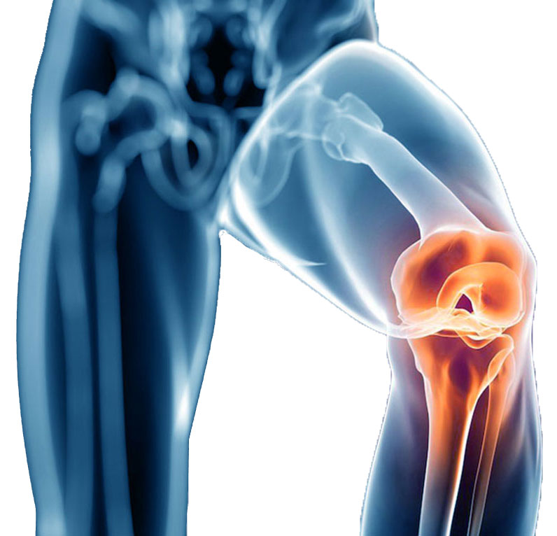 Image showing a body scan of a knee injury